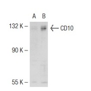 CD10 Antibody (H-321) FITC