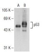 p53 Antibody (FL-393) FITC