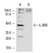 IL-8RB Antibody (K-19) PE