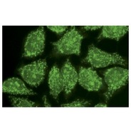 JNK1/3 Antibody (C-17)