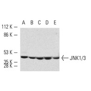 JNK1/3 Antibody (C-17)