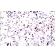 p-c-Myc Antibody (Thr 358)