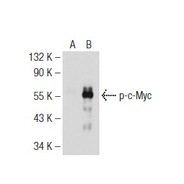 p-c-Myc Antibody (Thr 58)