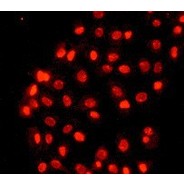 c-Myc Antibody Phospho (pT58/pS62)