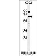 LRRC63 Antibody (C-term)