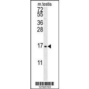 RT18C Antibody  (C-term)