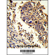 LUC7L Antibody (C-term)