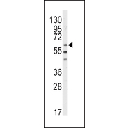 LYN Antibody (N-term)