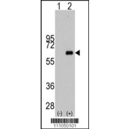 MYC Antibody (S373)