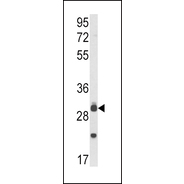 MyD88 Antibody (Center)