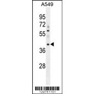 MYBPHL Antibody (N-term)