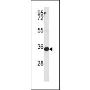 MTHFD2 Antibody (C-term)