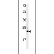 MSRA Antibody (N-term)