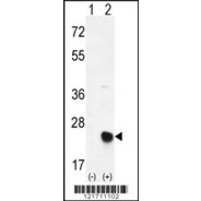 MSRB2 Antibody (Center)