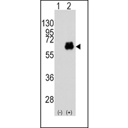 MYC Antibody (T58)