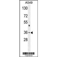 M6PR Antibody (C-term)