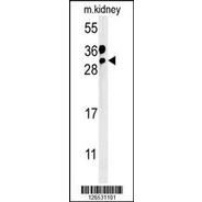 NICN1 Antibody  (C-term)