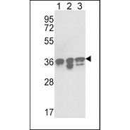 NPM1 Antibody (N-term)