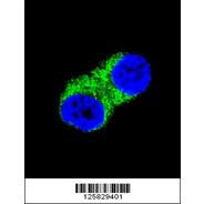 NFKBIA (Ser32) Antibody