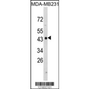 NDRG1 Antibody (N-term)