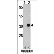 NPM1 Antibody (C-term)