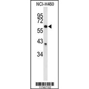 NOP5/NOP58 Antibody (N-term)