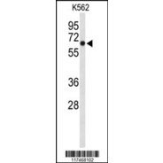 NOP5/NOP58 Antibody (C-term)