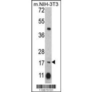 NPC2 Antibody (C-term)