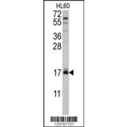 NDUFB7 Antibody (C-term)
