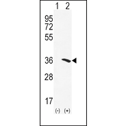 NAT2 Antibody (C-term)