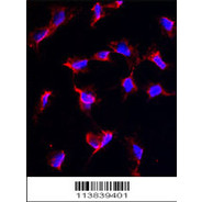 Nanos Homologue 1 (NANOS1) Antibody (C-term)