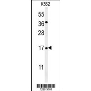 NAT13 Antibody (C-term)