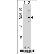 NDUFS4 Antibody (C-term)